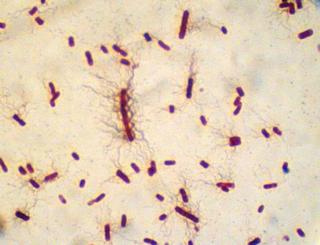 Proteus vulgaris Gram Stain (negative).jpg