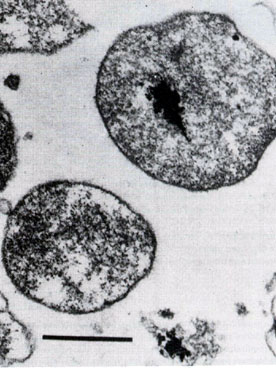 Thermoplasma.acidophilum.jpg