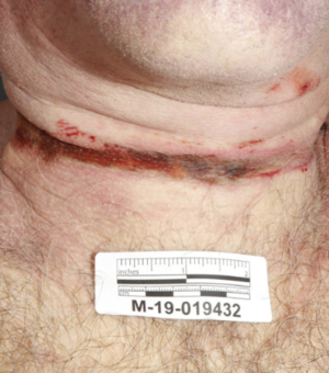 Epstein neck.png