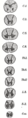 Cross-sections of the spinal cord at varying levels.