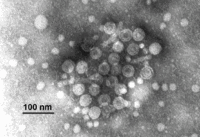 Hepatitis B virus EM