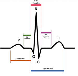 SinusRhythmLabels.gif